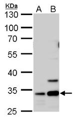 Annexin V Antibody in Western Blot (WB)