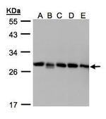 D4-GDI Antibody in Western Blot (WB)