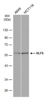 KLF5 Antibody in Western Blot (WB)