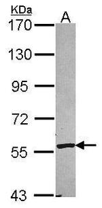 CYP2A6 Antibody in Western Blot (WB)