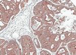 NOV Antibody in Immunohistochemistry (Paraffin) (IHC (P))