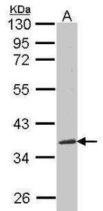 NOV Antibody in Western Blot (WB)