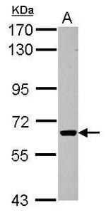 ACVR1C Antibody in Western Blot (WB)