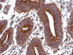 Vitronectin Antibody in Immunohistochemistry (Paraffin) (IHC (P))