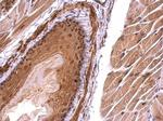 Monoacylglycerol Lipase Antibody in Immunohistochemistry (Paraffin) (IHC (P))