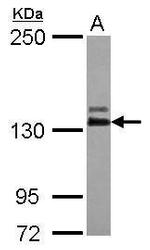 Abl2 Antibody in Western Blot (WB)