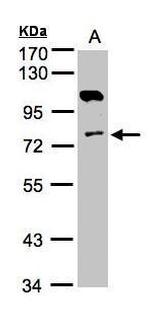 Adenylate Kinase 7 Antibody in Western Blot (WB)