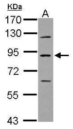 PLA2G6 Antibody in Western Blot (WB)