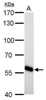 CYP27A1 Antibody in Western Blot (WB)