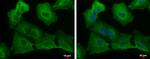 USP8 Antibody in Immunocytochemistry (ICC/IF)