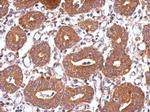 USP8 Antibody in Immunohistochemistry (Paraffin) (IHC (P))