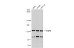 USP8 Antibody in Western Blot (WB)