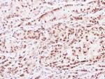 PRMT2 Antibody in Immunohistochemistry (Paraffin) (IHC (P))