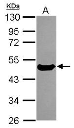 Cytokeratin 17 Antibody in Western Blot (WB)