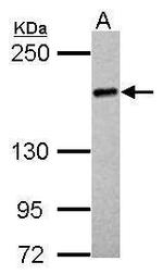 UGGT2 Antibody in Western Blot (WB)