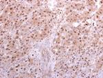 PSMA5 Antibody in Immunohistochemistry (Paraffin) (IHC (P))