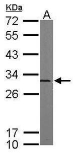 PSMA5 Antibody in Western Blot (WB)