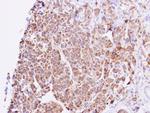 GNAL Antibody in Immunohistochemistry (Paraffin) (IHC (P))