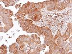 DVL2 Antibody in Immunohistochemistry (Paraffin) (IHC (P))