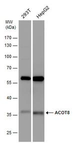 ACOT8 Antibody in Western Blot (WB)