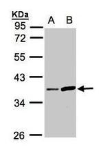 Prostasin Antibody in Western Blot (WB)