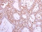 CDK6 Antibody in Immunohistochemistry (Paraffin) (IHC (P))