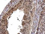 CDK6 Antibody in Immunohistochemistry (Paraffin) (IHC (P))