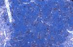 CDK6 Antibody in Immunohistochemistry (Paraffin) (IHC (P))