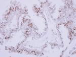 ST6GAL1 Antibody in Immunohistochemistry (Paraffin) (IHC (P))