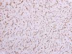 ST6GAL1 Antibody in Immunohistochemistry (Paraffin) (IHC (P))