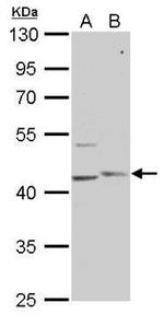 PHKG1 Antibody in Western Blot (WB)