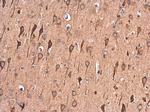 RAP Antibody in Immunohistochemistry (Paraffin) (IHC (P))