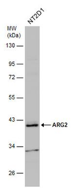 Arginase 2 Antibody in Western Blot (WB)