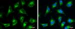 PDHB Antibody in Immunocytochemistry (ICC/IF)