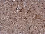 PDHB Antibody in Immunohistochemistry (Paraffin) (IHC (P))