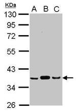 PDHB Antibody in Western Blot (WB)