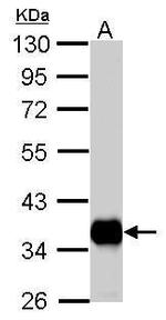 PDHB Antibody in Western Blot (WB)