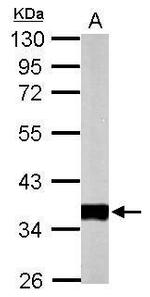 PDHB Antibody in Western Blot (WB)