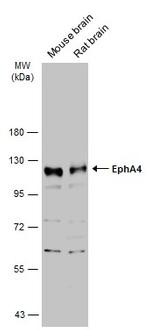 EphA4 Antibody in Western Blot (WB)