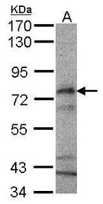 CPT2 Antibody in Western Blot (WB)