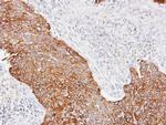 Cytokeratin 14 Antibody in Immunohistochemistry (Paraffin) (IHC (P))