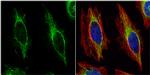 Cytokeratin 14 Antibody in Immunocytochemistry (ICC/IF)