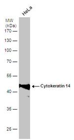 Cytokeratin 14 Antibody in Western Blot (WB)