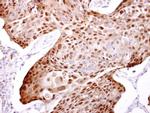 HSP70 Antibody in Immunohistochemistry (Paraffin) (IHC (P))