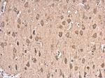 HSP70 Antibody in Immunohistochemistry (Paraffin) (IHC (P))