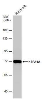 HSP70 Antibody in Western Blot (WB)