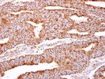 PACSIN2 Antibody in Immunohistochemistry (Paraffin) (IHC (P))