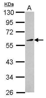 KLF12 Antibody in Western Blot (WB)