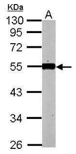 KLF12 Antibody in Western Blot (WB)