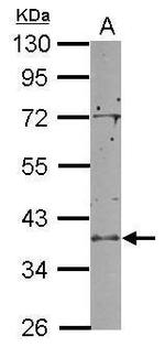 RCL1 Antibody in Western Blot (WB)